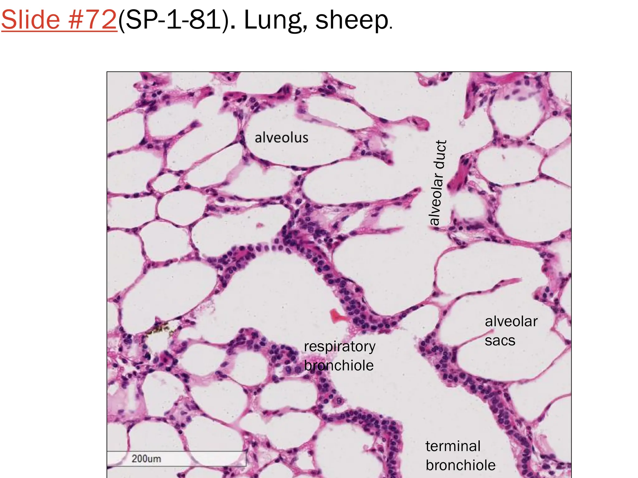 Slide #72(SP-1-81). Lung, sheep.
terminal
bronchiole
alveolar
sacs
respiratory
bronchiole
 