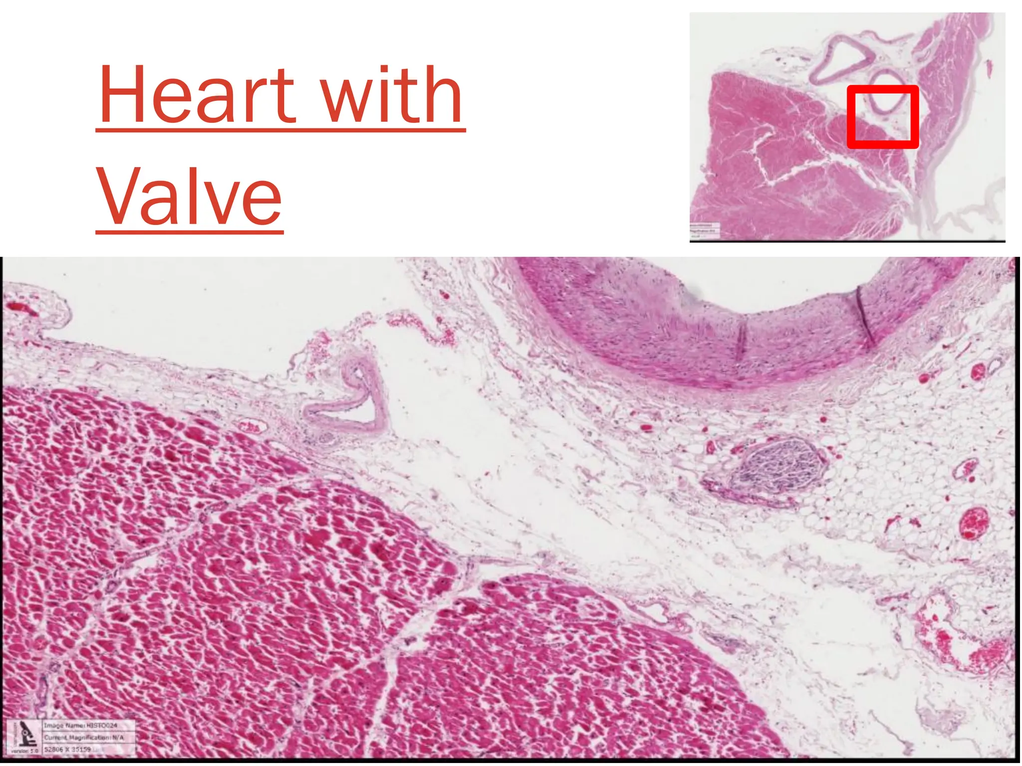 Heart with
Valve
 