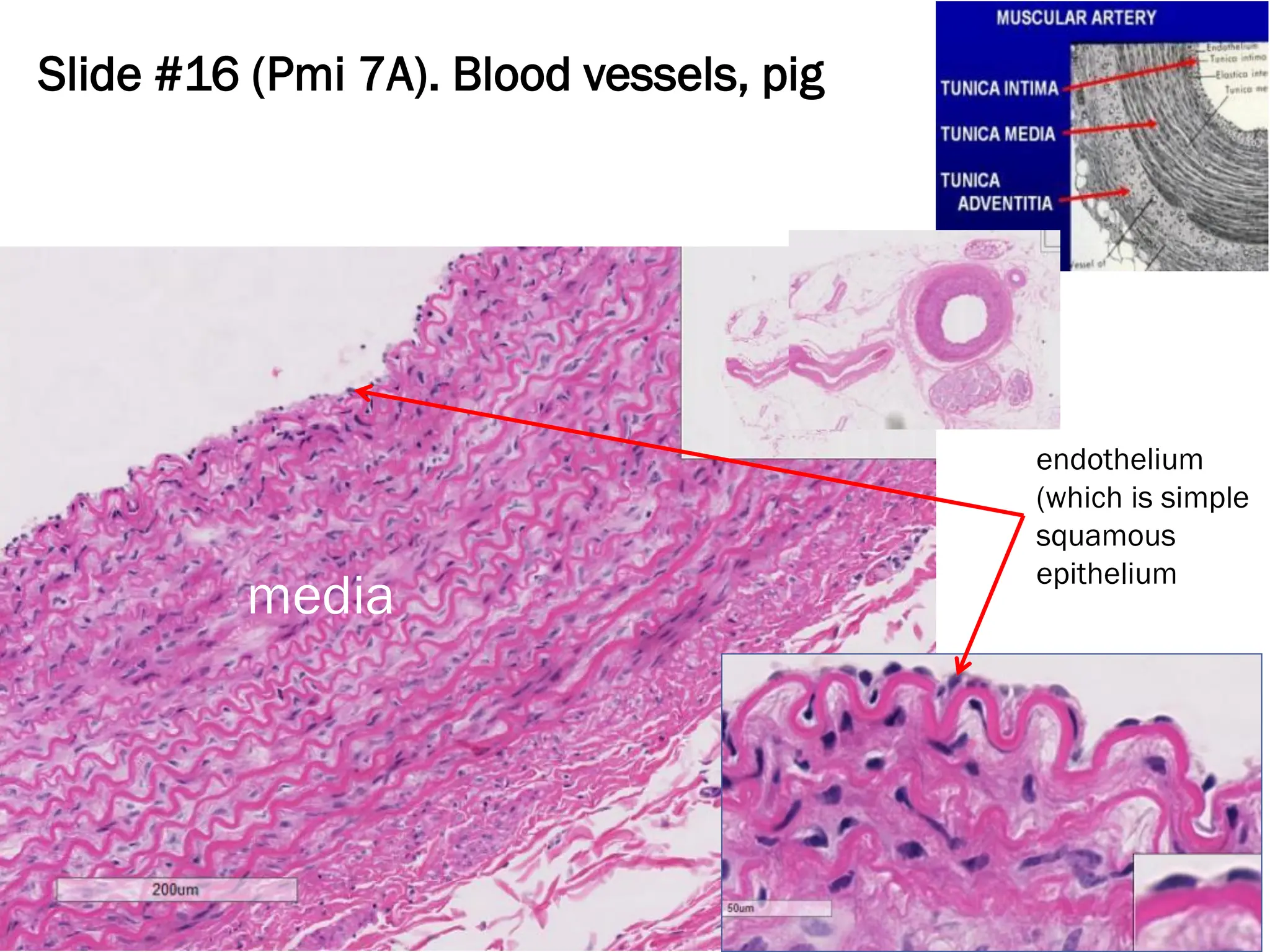 Slide #16 (Pmi 7A). Blood vessels, pig
endothelium
(which is simple
squamous
epithelium
media
 