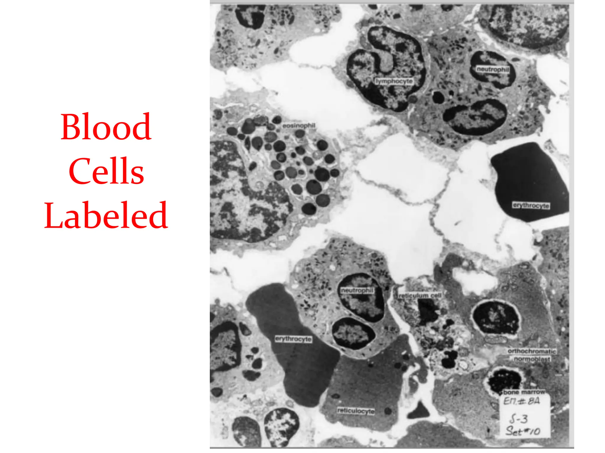 Blood
Cells
Labeled
 