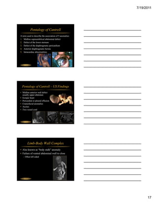 7/19/2011




                  Pentalogy of Cantrell
A term used to describe the association of 5 anomalies:
1. Midline supraumbilical abdominal defect
2. Defect of the lower sternum
3.
3 Defect of the diaphragmatic pericardium
4. Anterior diaphragmatic hernia
5. Intracardiac abnormalities




  Fetal Abdomen




   Pentalogy of Cantrell – US Findings
• Midline anterior wall defect
  usually upper abdomen
• Ectopic heart
• Pericardial or pleural effusion
• Craniofacial anomalies
• Ascites
• Two vessel cord




  Fetal Abdomen




            Limb-Body Wall Complex
• Also known as “body stalk” anomaly
• Failure of ventral abdominal wall to close
     – Often left sided




Jane J.K. Burns, RDMS
   Fetal Abdomen




                                                                17
 