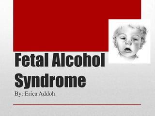 Fetal Alcohol
Syndrome
By: Erica Addoh
 