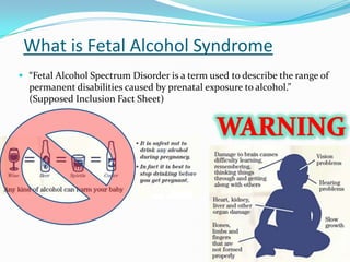 Fetal alcohol syndrome | PPTX