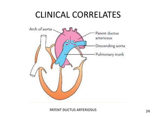 CLINICAL CORRELATES
PATENT DUCTUS ARTERIOSUS 24
 