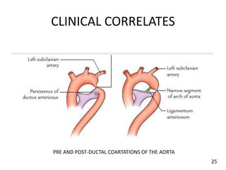 CLINICAL CORRELATES
PRE AND POST-DUCTAL COARTATIONS OF THE AORTA
25
 