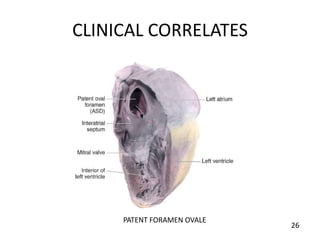 CLINICAL CORRELATES
PATENT FORAMEN OVALE
26
 