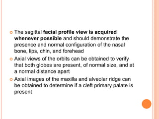  The sagittal facial profile view is acquired
whenever possible and should demonstrate the
presence and normal configuration of the nasal
bone, lips, chin, and forehead
 Axial views of the orbits can be obtained to verify
that both globes are present, of normal size, and at
a normal distance apart
 Axial images of the maxilla and alveolar ridge can
be obtained to determine if a cleft primary palate is
present
 