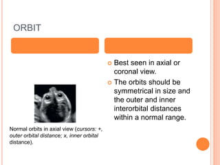 ORBIT
 Best seen in axial or
coronal view.
 The orbits should be
symmetrical in size and
the outer and inner
interorbital distances
within a normal range.
Normal orbits in axial view (cursors: +,
outer orbital distance; x, inner orbital
distance).
 