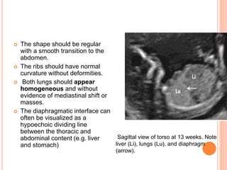  The shape should be regular
with a smooth transition to the
abdomen.
 The ribs should have normal
curvature without deformities.
 Both lungs should appear
homogeneous and without
evidence of mediastinal shift or
masses.
 The diaphragmatic interface can
often be visualized as a
hypoechoic dividing line
between the thoracic and
abdominal content (e.g. liver
and stomach)
Sagittal view of torso at 13 weeks. Note
liver (Li), lungs (Lu), and diaphragm
(arrow).
 