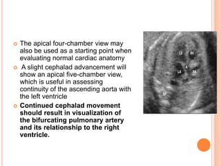  The apical four-chamber view may
also be used as a starting point when
evaluating normal cardiac anatomy
 A slight cephalad advancement will
show an apical five-chamber view,
which is useful in assessing
continuity of the ascending aorta with
the left ventricle
 Continued cephalad movement
should result in visualization of
the bifurcating pulmonary artery
and its relationship to the right
ventricle.
 