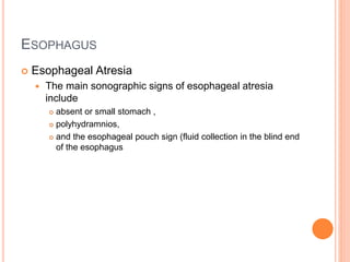 ESOPHAGUS
 Esophageal Atresia
 The main sonographic signs of esophageal atresia
include
 absent or small stomach ,
 polyhydramnios,
 and the esophageal pouch sign (fluid collection in the blind end
of the esophagus
 
