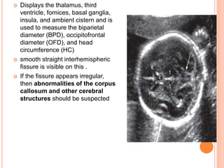  Displays the thalamus, third
ventricle, fornices, basal ganglia,
insula, and ambient cistern and is
used to measure the biparietal
diameter (BPD), occipitofrontal
diameter (OFD), and head
circumference (HC)
 smooth straight interhemispheric
fissure is visible on this .
 If the fissure appears irregular,
then abnormalities of the corpus
callosum and other cerebral
structures should be suspected
 