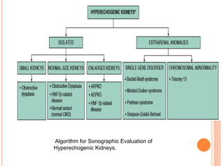 Algorithm for Sonographic Evaluation of
Hyperechogenic Kidneys.
 