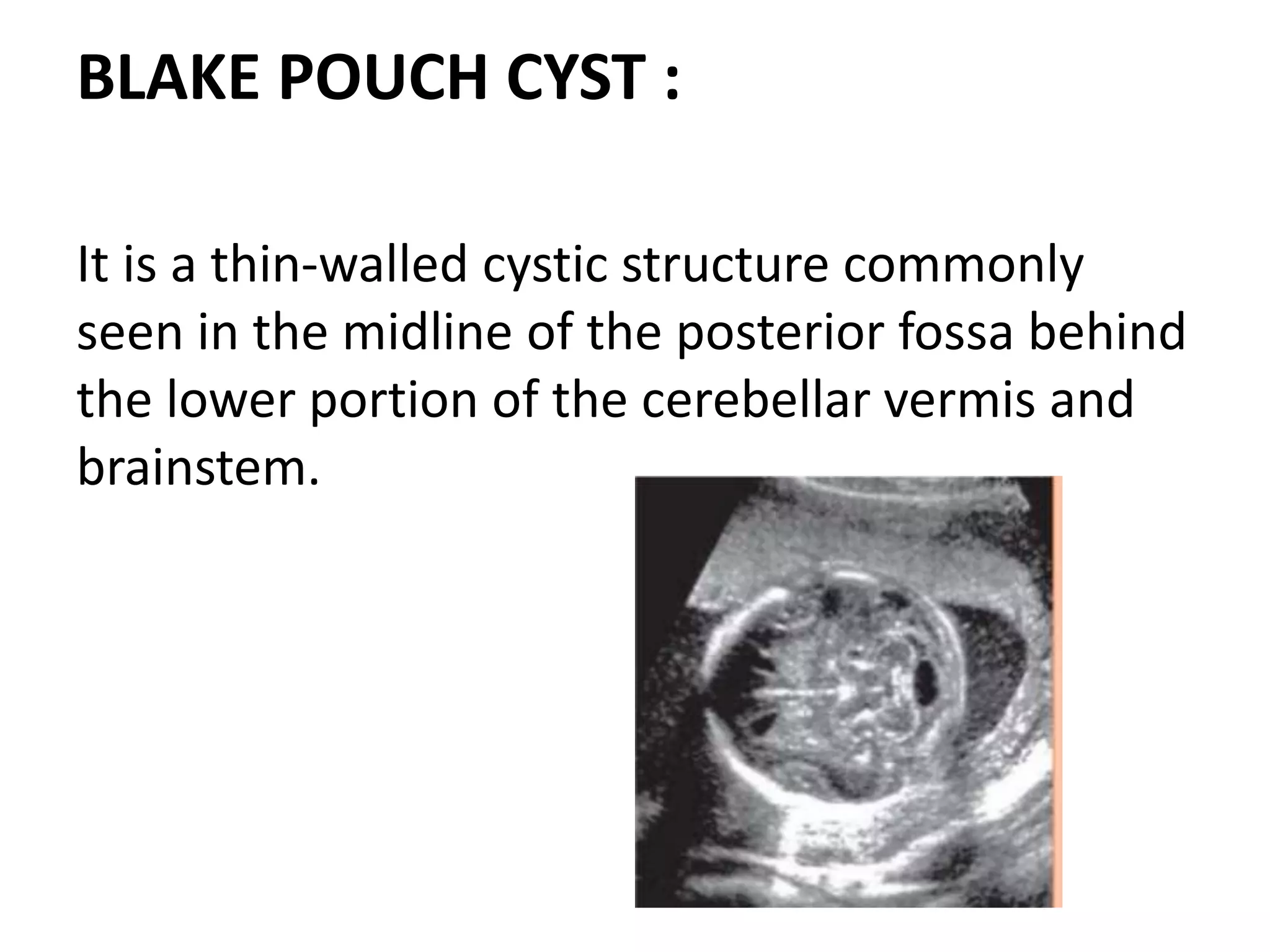 Fetal anomaly scan | PPTX