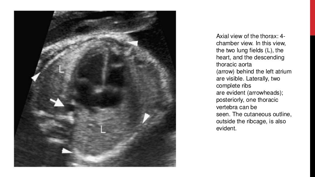 Fetal Anomaly Scan Chest GIT GUT