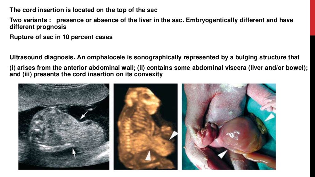 fetal-anomaly-scan-chest-git-gut