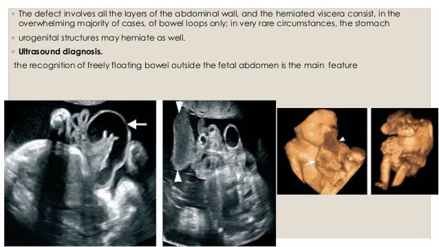 Fetal anomaly scan pt2