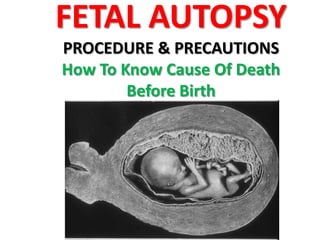 FETAL AUTOPSY
PROCEDURE & PRECAUTIONS
How To Know Cause Of Death
Before Birth

 