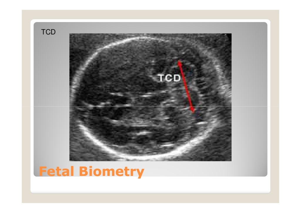 Fetal Biometry fetal-biometry