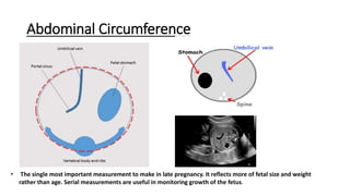 Abdominal Circumference
• The single most important measurement to make in late pregnancy. It reflects more of fetal size and weight
rather than age. Serial measurements are useful in monitoring growth of the fetus.
 