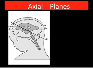 Axial Planes
Sunday, July 28, 13
 