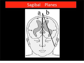 Sagibal Planes
Sunday, July 28, 13
 