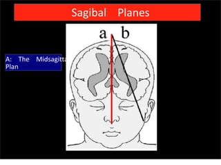 Sagibal Planes
A: The Midsagittal
Plan
Sunday, July 28, 13
 