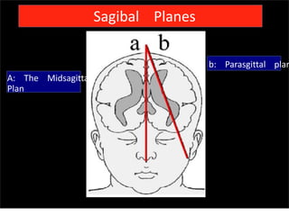 Sagibal Planes
b: Parasgittal plan
A: The Midsagittal
Plan
Sunday, July 28, 13
 