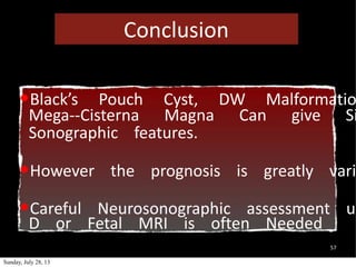 57
•Black’s Pouch Cyst, DW Malformatio
Mega-‐Cisterna Magna Can give Si
Sonographic features.
•However the prognosis is greatly vari
•Careful Neurosonographic assessment us
D or Fetal MRI is often Needed
Conclusion
Sunday, July 28, 13
 