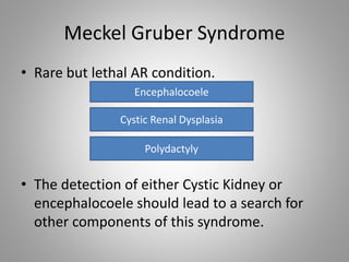 Meckel Gruber Syndrome
• Rare but lethal AR condition.
• The detection of either Cystic Kidney or
encephalocoele should lead to a search for
other components of this syndrome.
Encephalocoele
Cystic Renal Dysplasia
Polydactyly
 