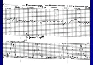 Fetal Cardiotocograph (CTG).pptx