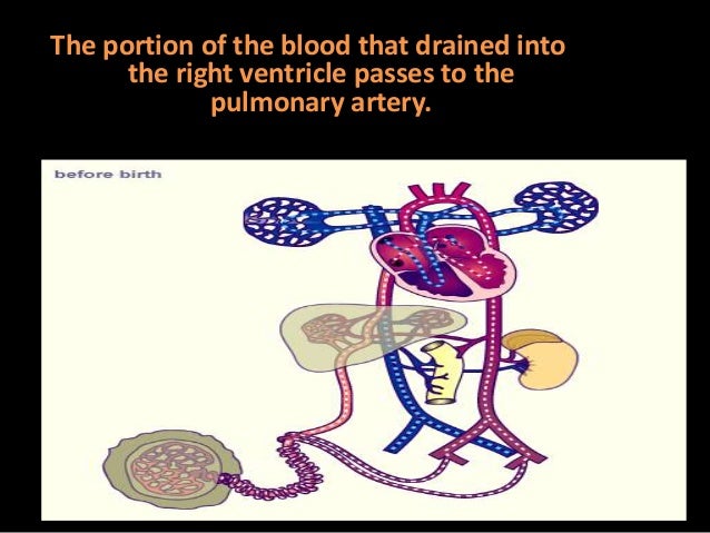 Ductus arteriosus in adults is called
