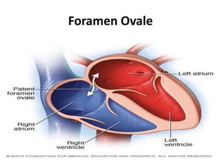 Foramen Ovale
 