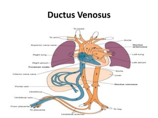 Ductus Venosus
 