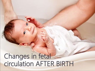 Changes in fetal
circulation AFTER BIRTH
 