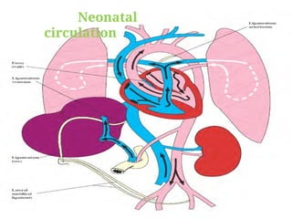 Neonatal
circulation
 