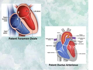 Fetal circulation (for mbbs) | PPTX