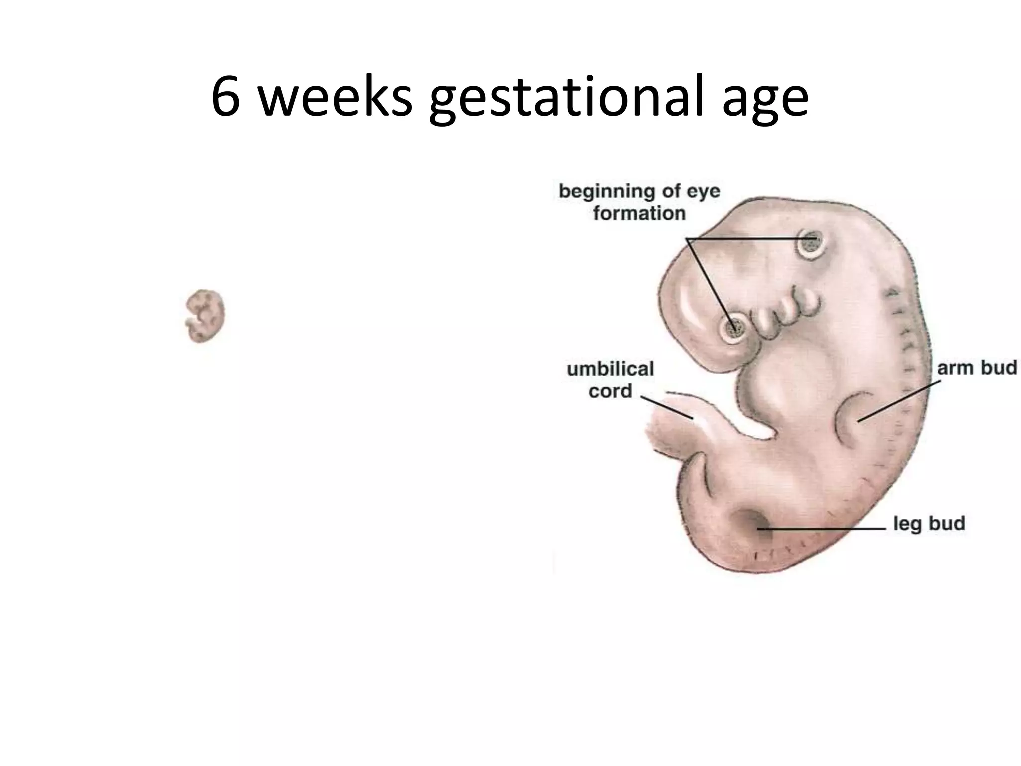 6 weeks gestational age
 
