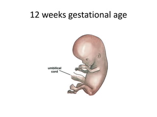 12 weeks gestational age
 