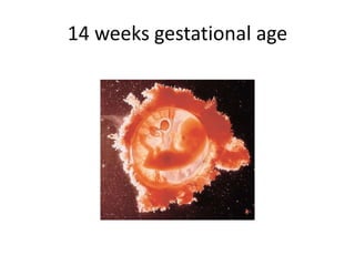 14 weeks gestational age
 