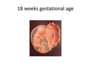 18 weeks gestational age
 