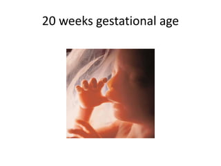 20 weeks gestational age
 