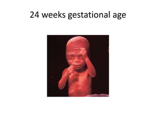 24 weeks gestational age
 