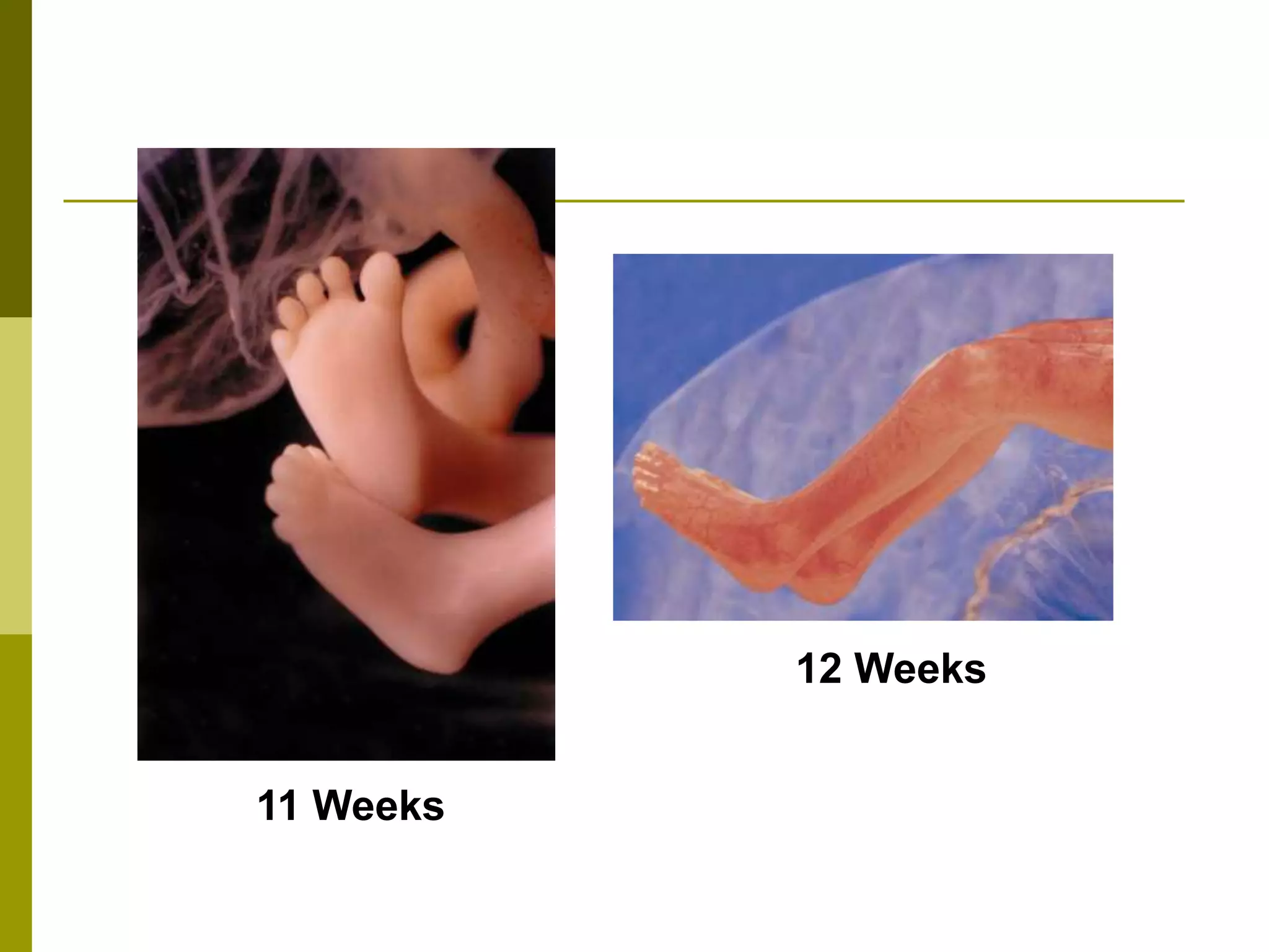 11 Weeks
12 Weeks
 