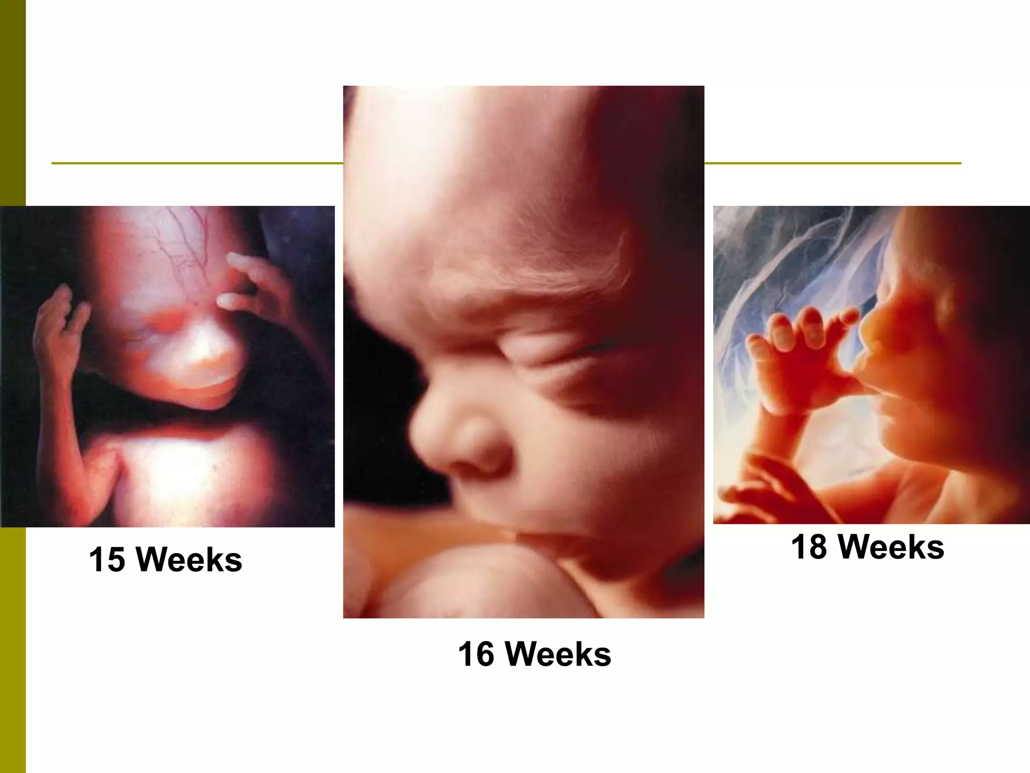 15 Weeks
16 Weeks
18 Weeks
 