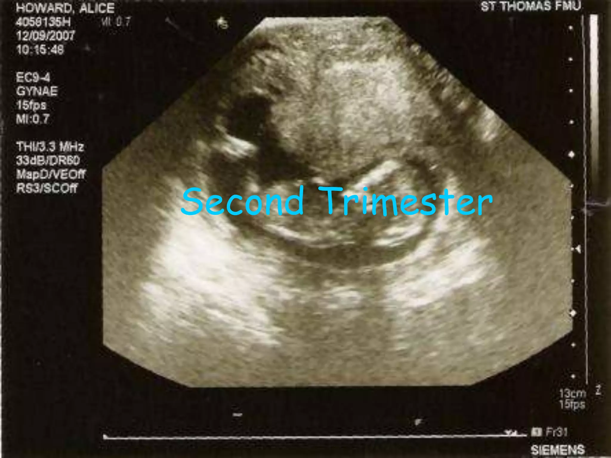 Week 7Your embryo is now about ½ and inch long this week. The head is very outsized for all of the facial features that are  becoming more obvious. The eyes are now formed but won`t open until the 28th week and the eyelids are beginning to form.  Your babies indentations and the semicircular canal is beginning to form in the inner ear to help with balance. Also, the brain is close to completion and is growing at an amazingly fast rate. The buds that are arms and legs are now noticeable. At this point the development of the arms will end and the hands will continue to grow over the next few days. Now the critical development of the legs will end soon, but the knees and ankles can be distinguished by small dots on the legs and the toes are notched and toenails are beginning to appear. At this time you can’t tell the difference from boys and girls yet by sight, but the gonads are formed.  The gonads are either the testes in the male, or the ovaries in the female. The heart is beating at around 150 beats per minute, about twice your heart rate, and will continue to do so throughout your pregnancy.  The kidneys produce urine for the first time.  Your baby will rapidly go through three sets of kidneys, the second set will form this week.  When bone marrow will form later and  it will take over the production of red blood cells, but for now the liver is working over time to produce these
