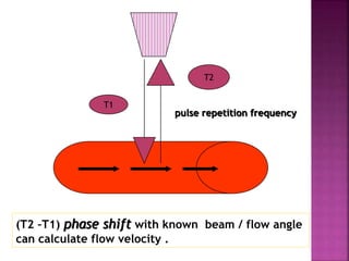 pulse repetition frequency
(T2 –T1) phase shift with known beam / flow angle
can calculate flow velocity .
T1
T2
 