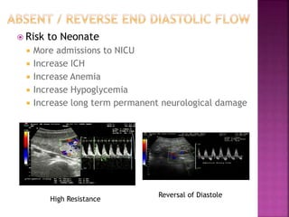  Risk to Neonate
 More admissions to NICU
 Increase ICH
 Increase Anemia
 Increase Hypoglycemia
 Increase long term permanent neurological damage
High Resistance
Reversal of Diastole
 