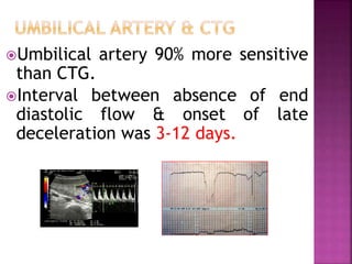 Umbilical artery 90% more sensitive
than CTG.
Interval between absence of end
diastolic flow & onset of late
deceleration was 3-12 days.
 