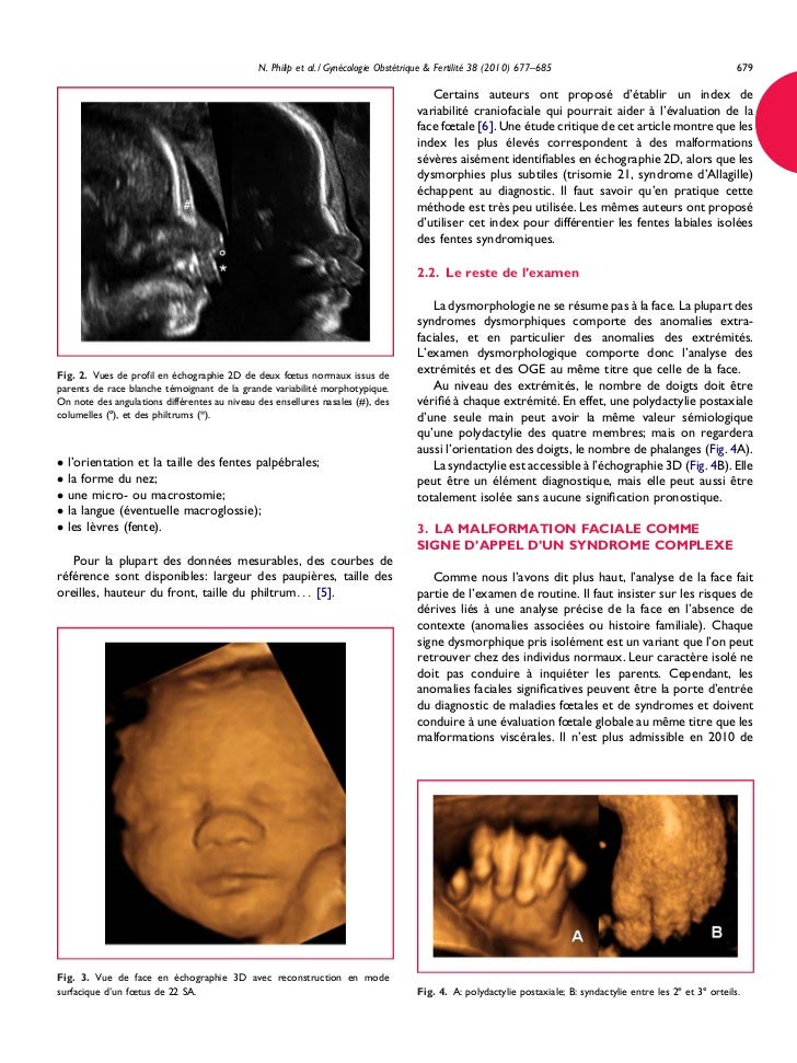 Fetal Dysmorphology